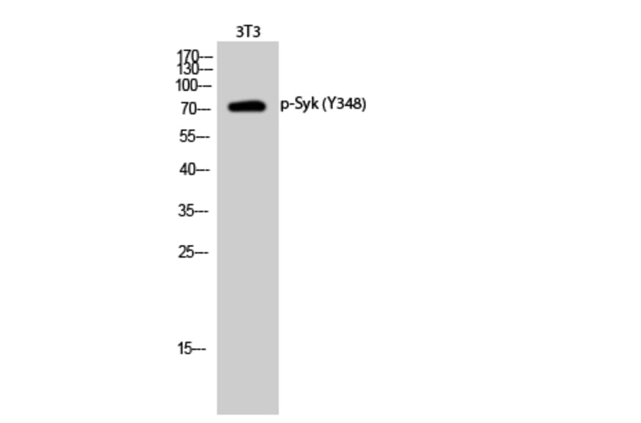 Western Blot - Anti-SYK (phospho Tyr348) Antibody (A0091) - Antibodies.com