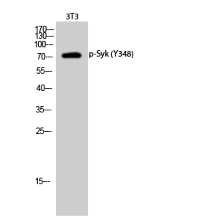 Western Blot - Anti-SYK (phospho Tyr348) Antibody (A0091) - Antibodies.com