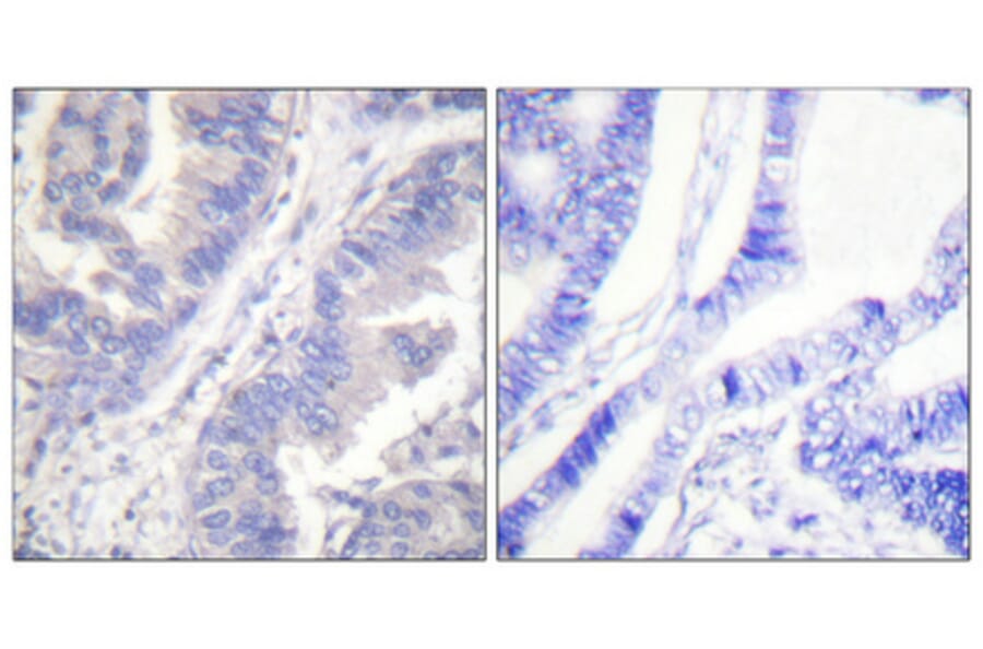 Immunohistochemistry - Anti-SYK (phospho Tyr348) Antibody (A0091) - Antibodies.com