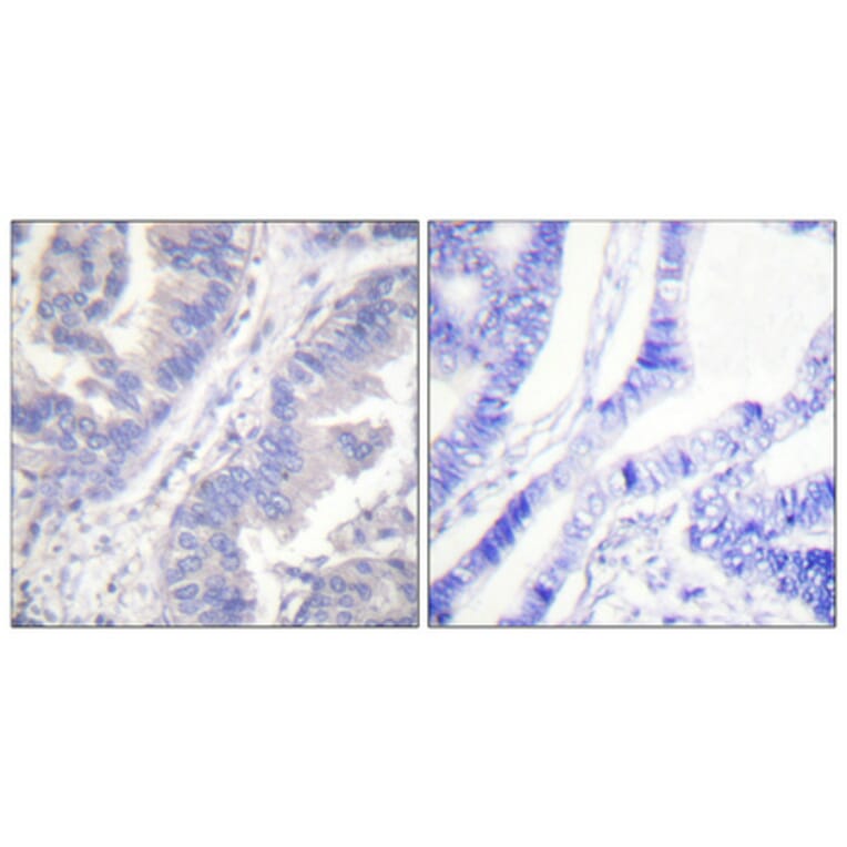 Immunohistochemistry - Anti-SYK (phospho Tyr348) Antibody (A0091) - Antibodies.com