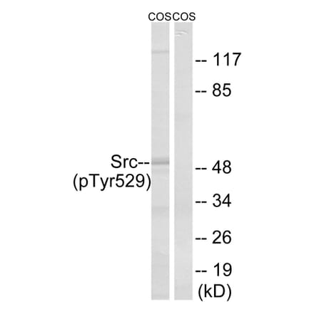 Western Blot - Anti-Src (phospho Tyr529) Antibody (A7220) - Antibodies.com