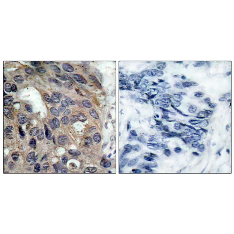 Immunohistochemistry - Anti-Src (phospho Tyr529) Antibody (A7220) - Antibodies.com