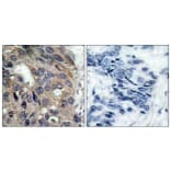 Immunohistochemistry - Anti-Src (phospho Tyr529) Antibody (A7220) - Antibodies.com