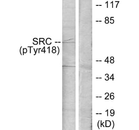 Western Blot - Anti-Src (phospho Tyr418) Antibody (A7219) - Antibodies.com