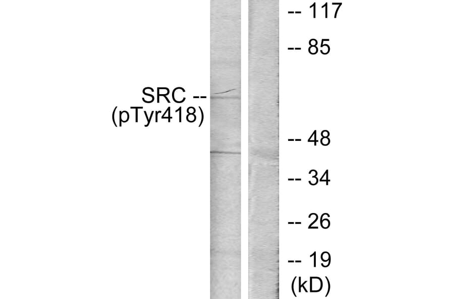 Western Blot - Anti-Src (phospho Tyr418) Antibody (A7219) - Antibodies.com
