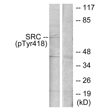 Western Blot - Anti-Src (phospho Tyr418) Antibody (A7219) - Antibodies.com