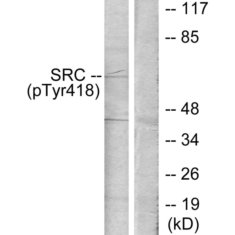 Western Blot - Anti-Src (phospho Tyr418) Antibody (A7219) - Antibodies.com