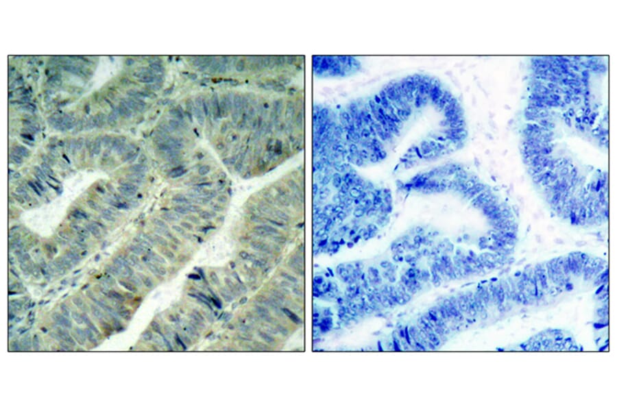 Immunohistochemistry - Anti-Src (phospho Tyr418) Antibody (A7219) - Antibodies.com