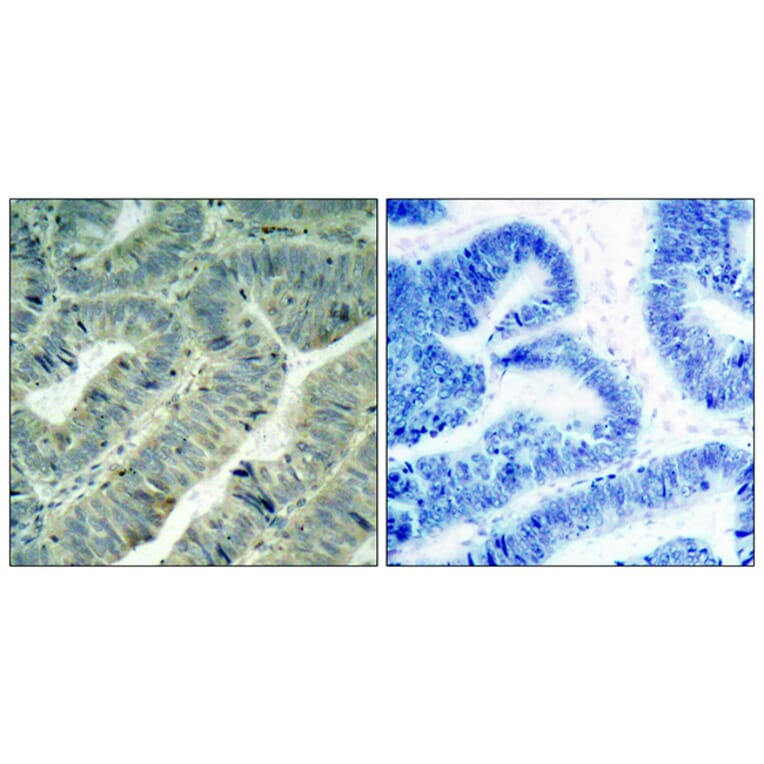 Immunohistochemistry - Anti-Src (phospho Tyr418) Antibody (A7219) - Antibodies.com