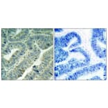 Immunohistochemistry - Anti-Src (phospho Tyr418) Antibody (A7219) - Antibodies.com