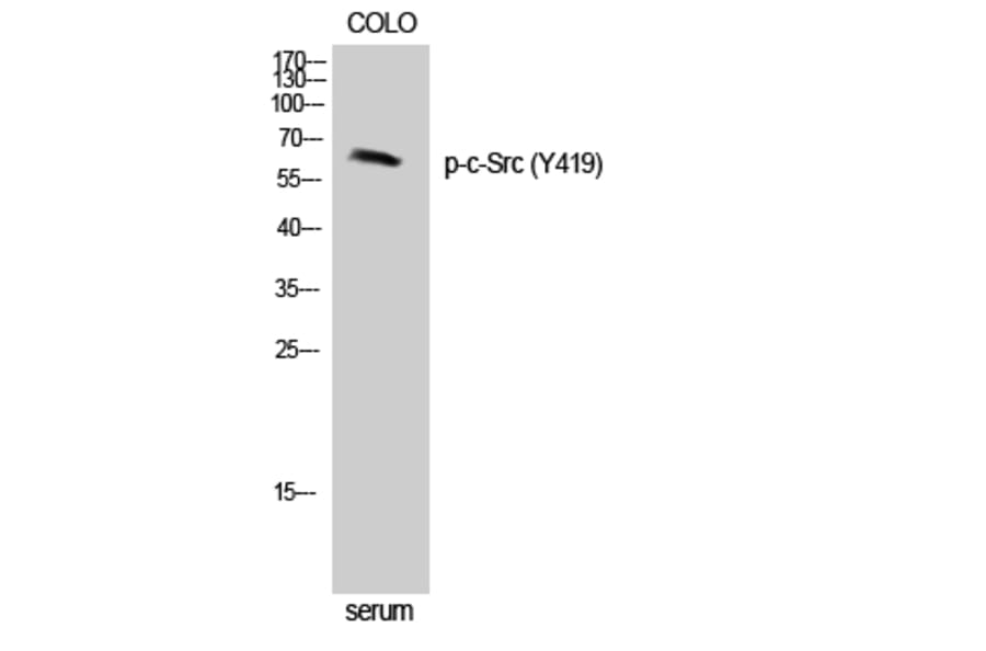 Western Blot - Anti-Src (phospho Tyr418) Antibody (A7219) - Antibodies.com
