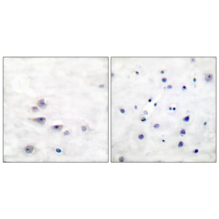 Immunohistochemistry - Anti-Shc (phospho Tyr427) Antibody (A0025) - Antibodies.com