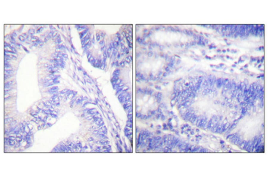 Immunohistochemistry - Anti-Shc (phospho Tyr427) Antibody (A0025) - Antibodies.com