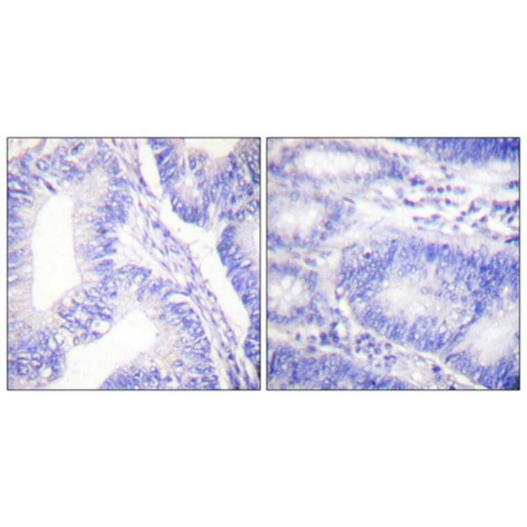 Immunohistochemistry - Anti-Shc (phospho Tyr427) Antibody (A0025) - Antibodies.com