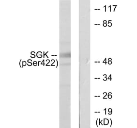 Western Blot - Anti-SGK (phospho Ser422) Antibody (A0087) - Antibodies.com