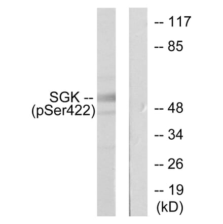 Western Blot - Anti-SGK (phospho Ser422) Antibody (A0087) - Antibodies.com