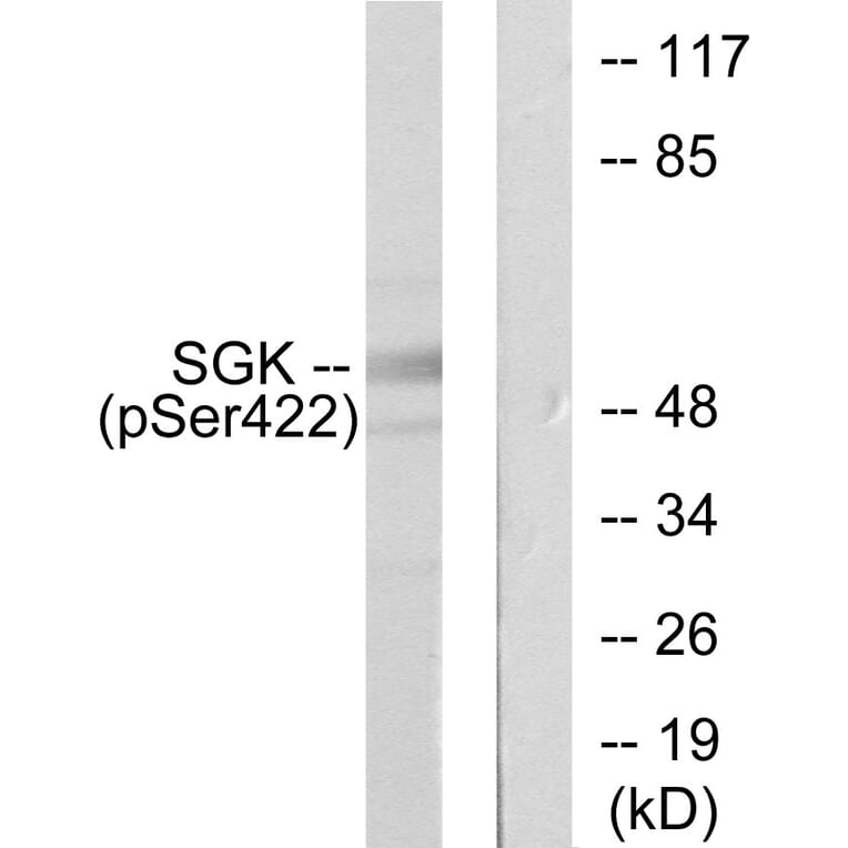 Western Blot - Anti-SGK (phospho Ser422) Antibody (A0087) - Antibodies.com