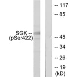 Western Blot - Anti-SGK (phospho Ser422) Antibody (A0087) - Antibodies.com