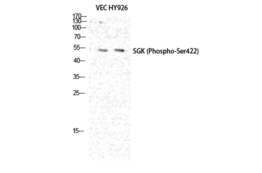 Western Blot - Anti-SGK (phospho Ser422) Antibody (A0087) - Antibodies.com
