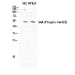 Western Blot - Anti-SGK (phospho Ser422) Antibody (A0087) - Antibodies.com