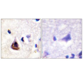 Immunohistochemistry - Anti-PI3-kinase p85-alpha Antibody (B1225) - Antibodies.com