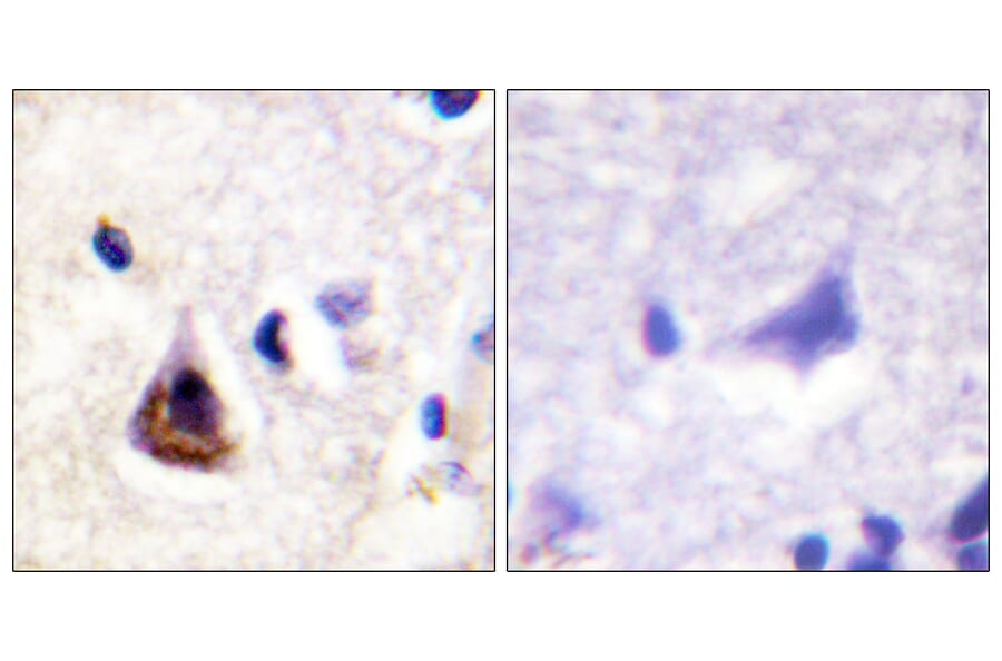 Immunohistochemistry - Anti-PI3-kinase p85-alpha Antibody (B1225) - Antibodies.com