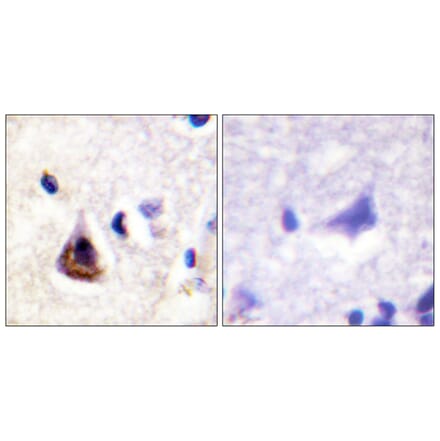 Immunohistochemistry - Anti-PI3-kinase p85-alpha Antibody (B1225) - Antibodies.com