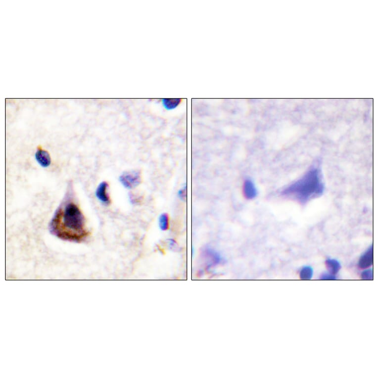 Immunohistochemistry - Anti-PI3-kinase p85-alpha Antibody (B1225) - Antibodies.com