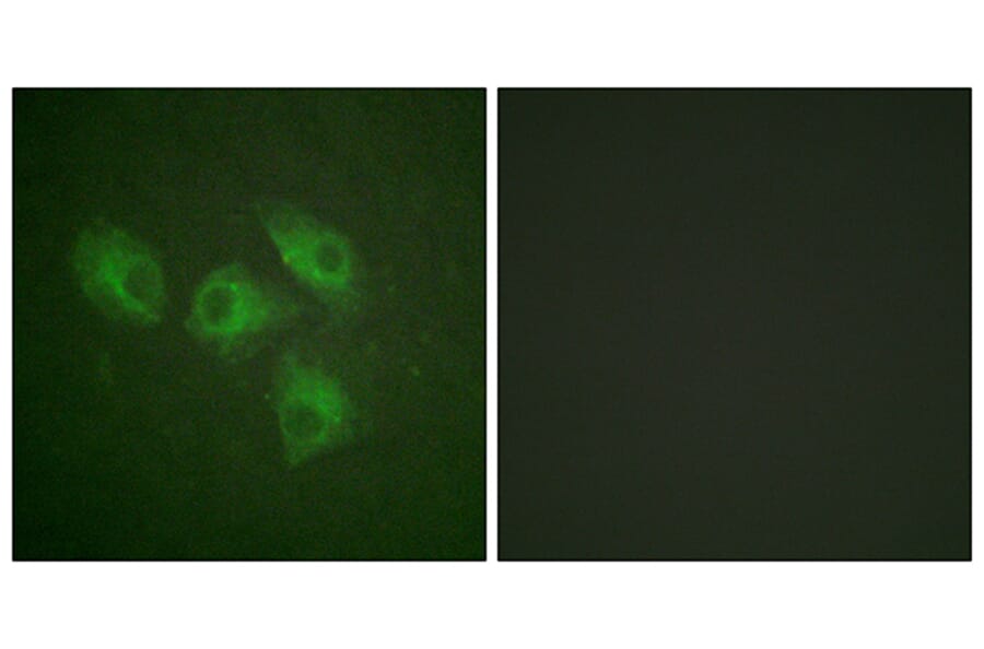 Immunofluorescence - Anti-PI3-kinase p85-alpha Antibody (B1225) - Antibodies.com