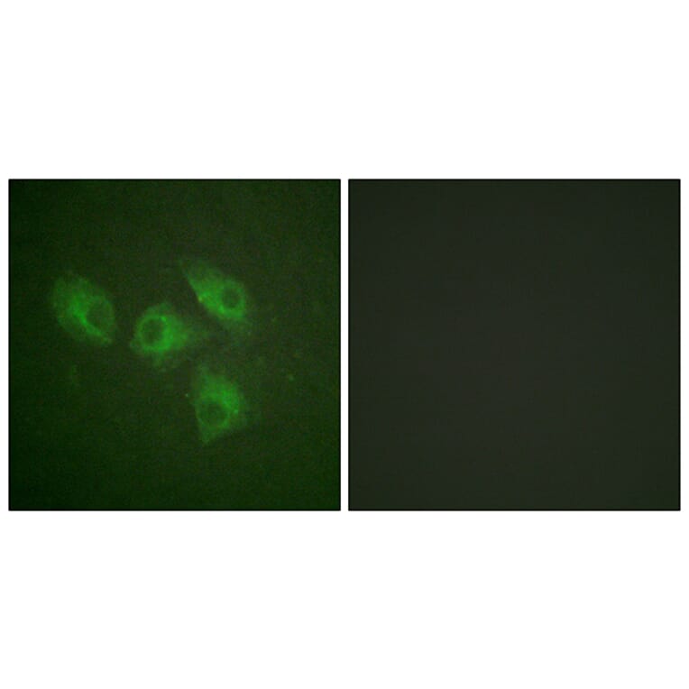 Immunofluorescence - Anti-PI3-kinase p85-alpha Antibody (B1225) - Antibodies.com
