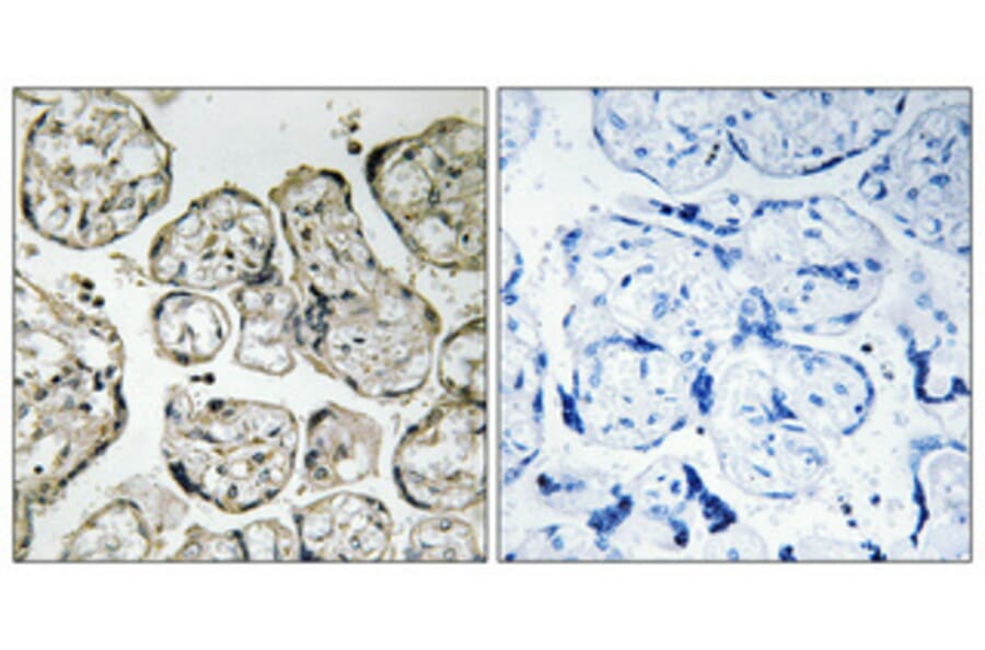 Immunohistochemistry - Anti-PI3-kinase p85-alpha Antibody (B1225) - Antibodies.com