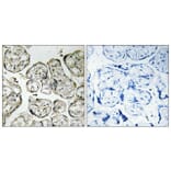 Immunohistochemistry - Anti-PI3-kinase p85-alpha Antibody (B1225) - Antibodies.com