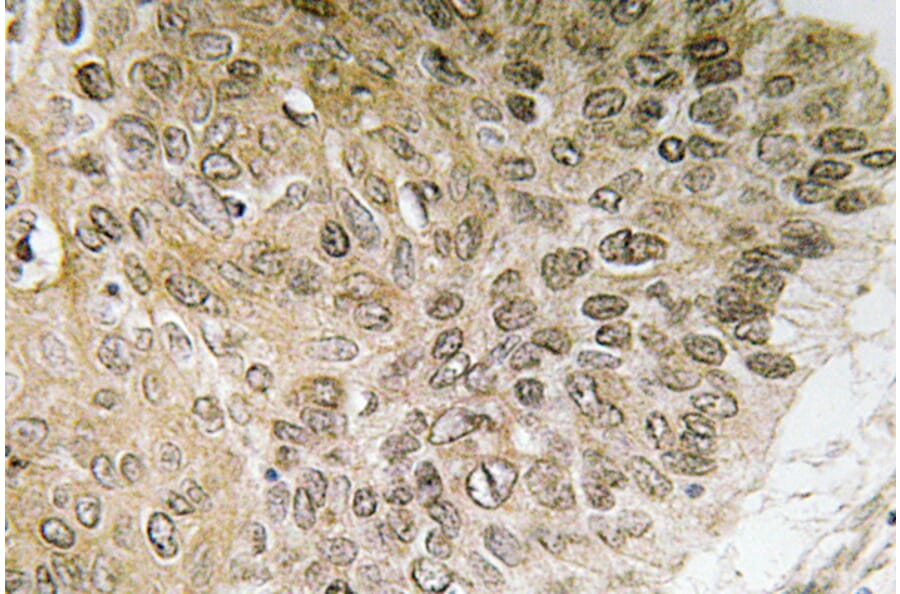 Immunohistochemistry - Anti-PI 3-kinase p85alpha Antibody (R12-2307) - Antibodies.com