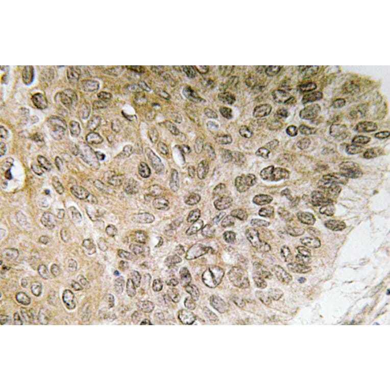 Immunohistochemistry - Anti-PI 3-kinase p85alpha Antibody (R12-2307) - Antibodies.com