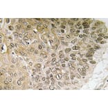 Immunohistochemistry - Anti-PI 3-kinase p85alpha Antibody (R12-2307) - Antibodies.com