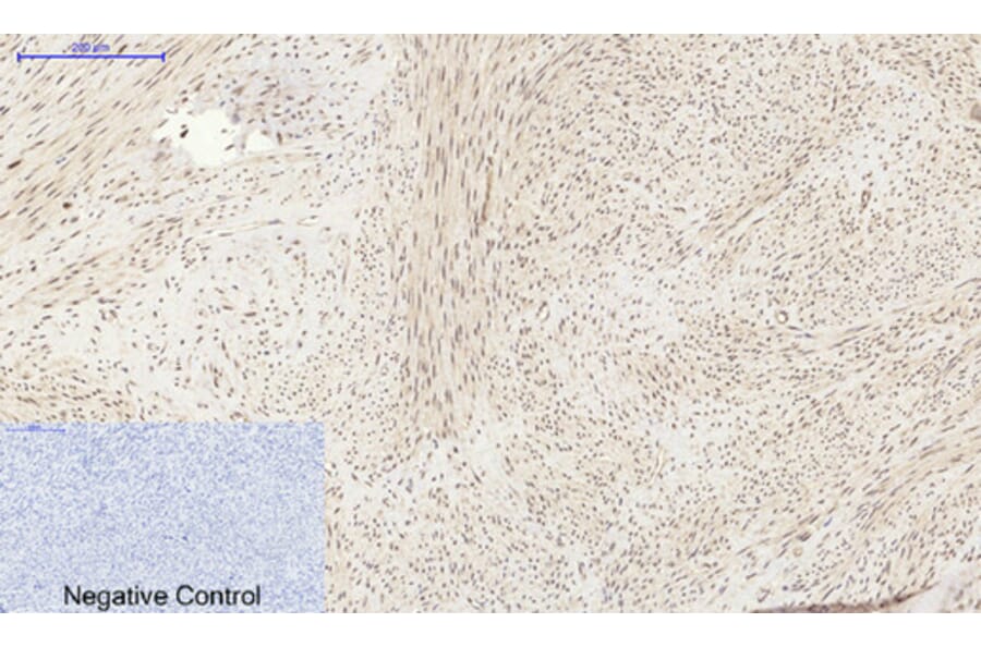 Immunohistochemistry - Anti-PI 3-kinase p85alpha Antibody (R12-2307) - Antibodies.com