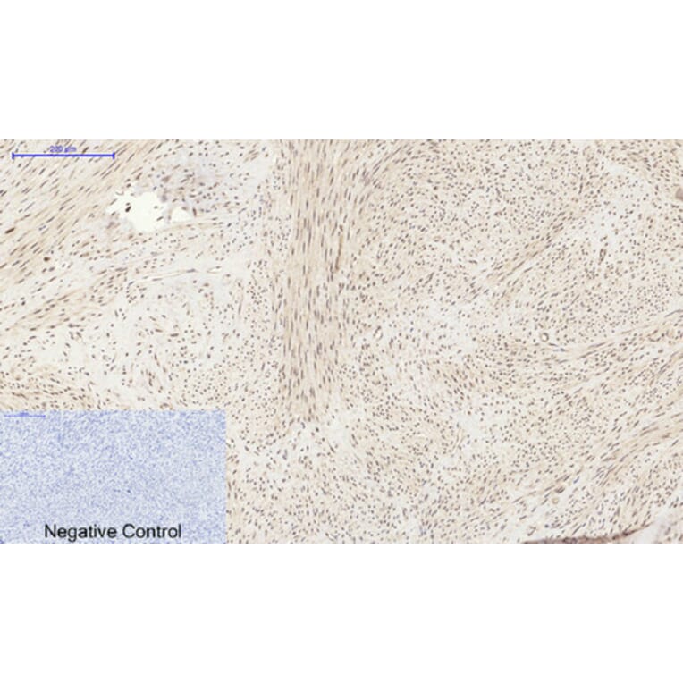 Immunohistochemistry - Anti-PI 3-kinase p85alpha Antibody (R12-2307) - Antibodies.com