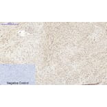 Immunohistochemistry - Anti-PI 3-kinase p85alpha Antibody (R12-2307) - Antibodies.com