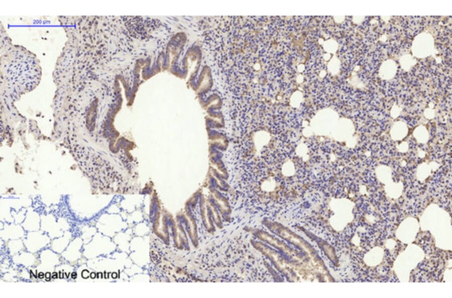 Immunohistochemistry - Anti-PI 3-kinase p85alpha Antibody (R12-2307) - Antibodies.com