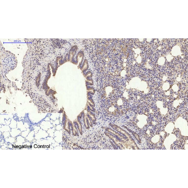 Immunohistochemistry - Anti-PI 3-kinase p85alpha Antibody (R12-2307) - Antibodies.com