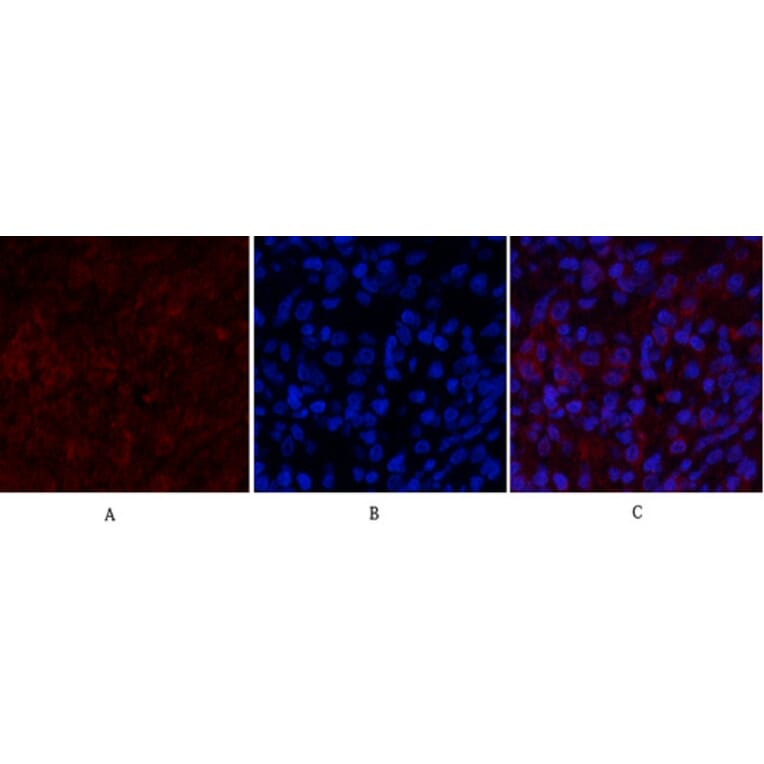 Immunofluorescence - Anti-PI 3-kinase p85alpha Antibody (R12-2307) - Antibodies.com