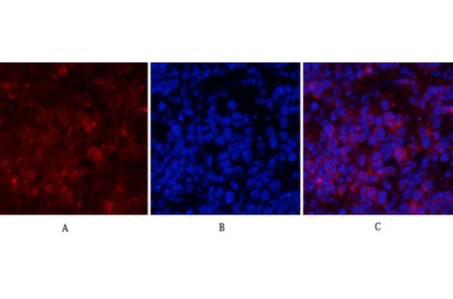Immunofluorescence - Anti-PI 3-kinase p85alpha Antibody (R12-2307) - Antibodies.com