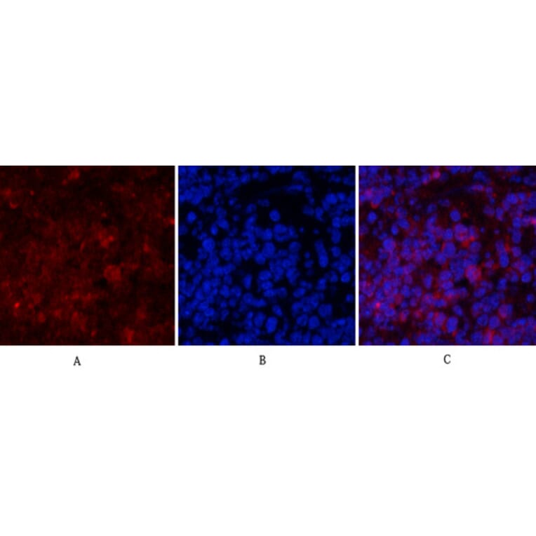 Immunofluorescence - Anti-PI 3-kinase p85alpha Antibody (R12-2307) - Antibodies.com