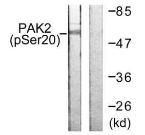Western Blot - Anti-PAK2 (phospho Ser20) Antibody (A0707) - Antibodies.com