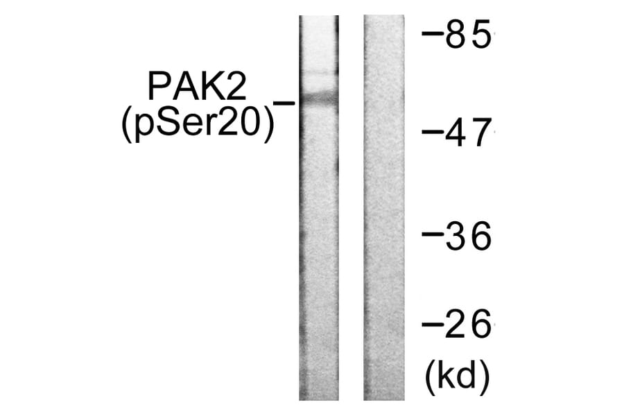 Western Blot - Anti-PAK2 (phospho Ser20) Antibody (A0707) - Antibodies.com