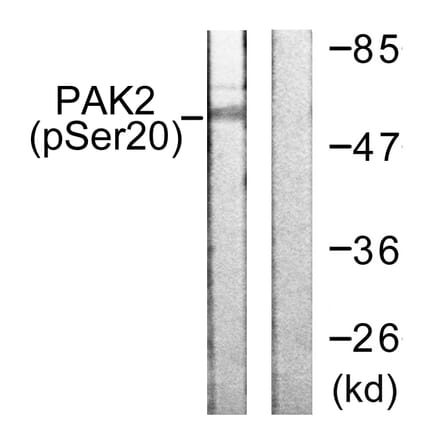 Western Blot - Anti-PAK2 (phospho Ser20) Antibody (A0707) - Antibodies.com