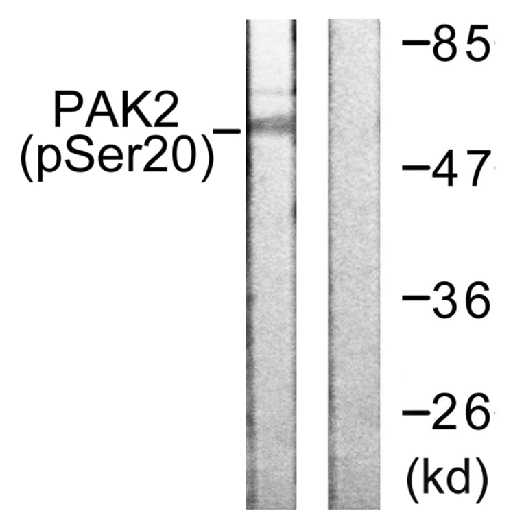 Western Blot - Anti-PAK2 (phospho Ser20) Antibody (A0707) - Antibodies.com