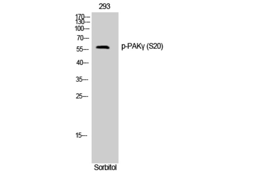 Western Blot - Anti-PAK2 (phospho Ser20) Antibody (A0707) - Antibodies.com