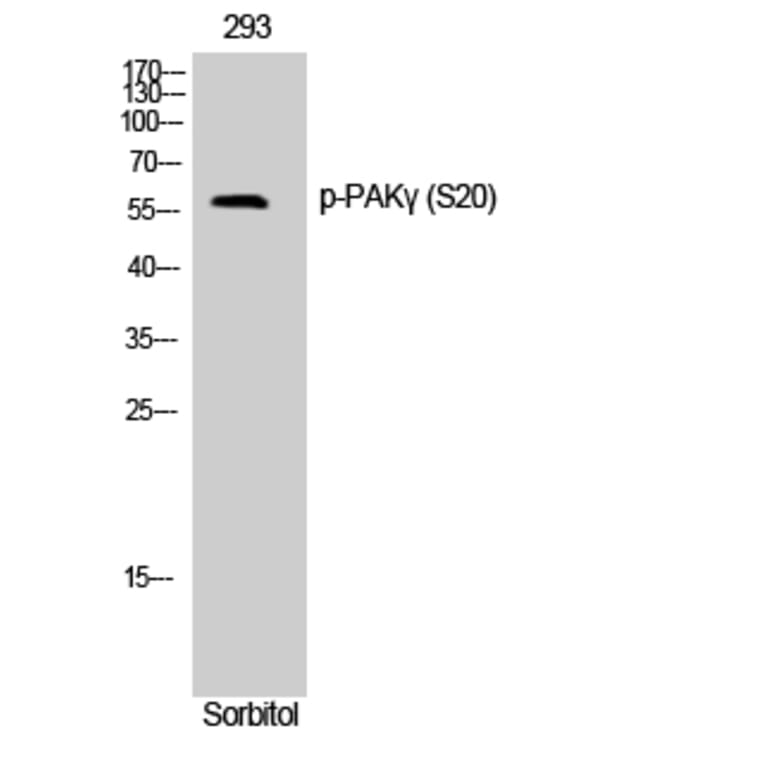 Western Blot - Anti-PAK2 (phospho Ser20) Antibody (A0707) - Antibodies.com