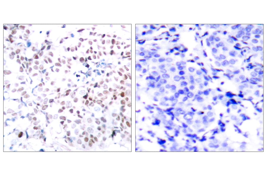 Immunohistochemistry - Anti-Myc (phospho Thr358) Antibody (A7158) - Antibodies.com
